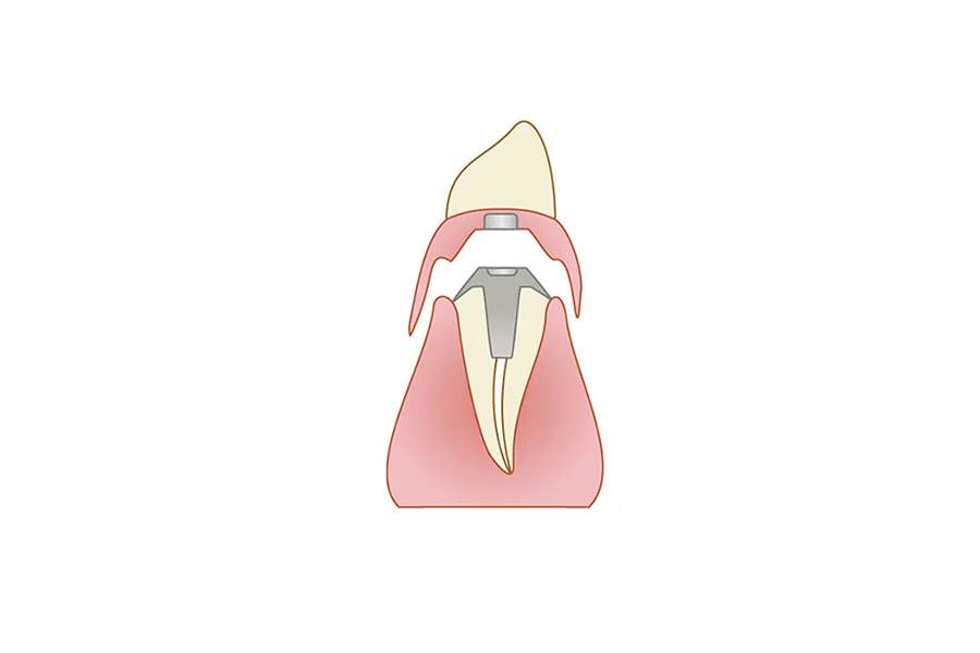 マグネット